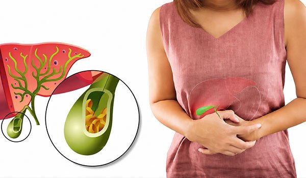 Gallbladder