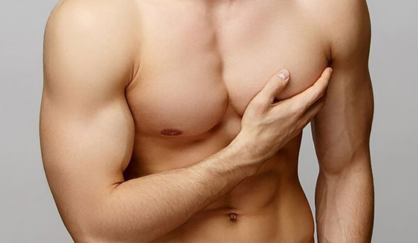 Gynecomastia